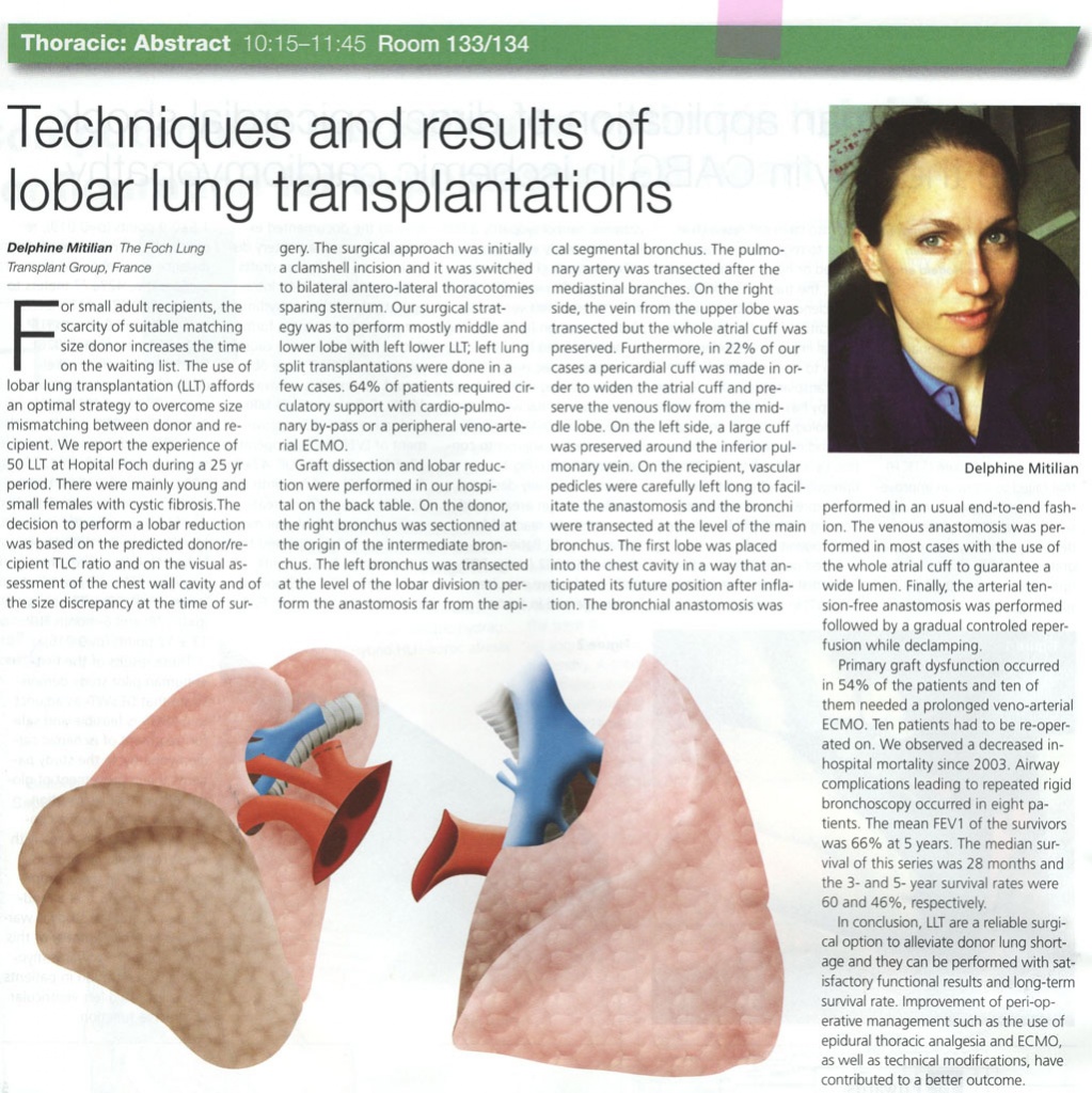 Techniques and results of lobar lung transplantations