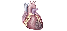 Сердце при воронкообразной деформации грудной клетки